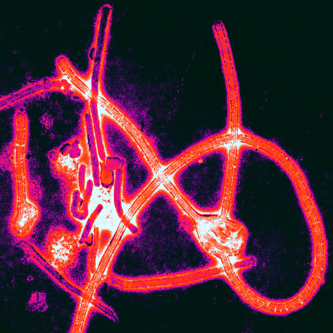 Ebola_virus_particles